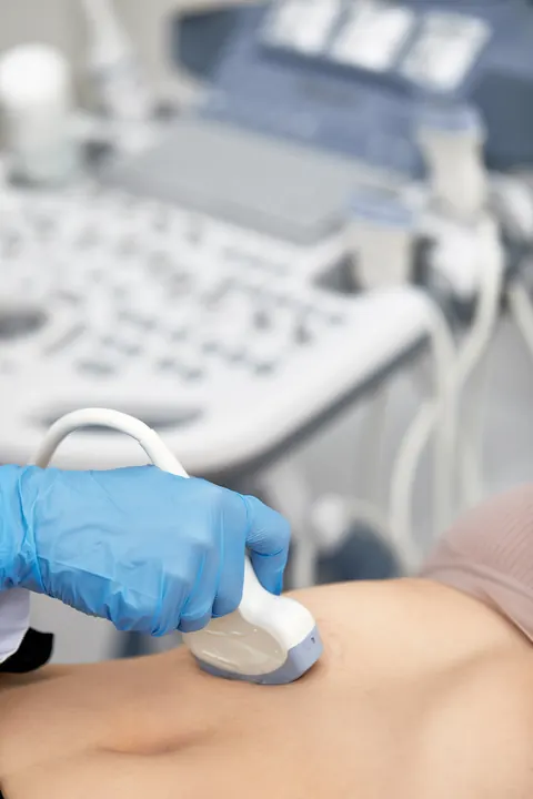 Mano con guante azul desliza el transductor de un ultrasonido sobre el abdomen.